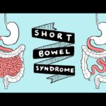 short bowel syndrome