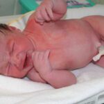 short stature in child born small for gestational age