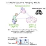 shy-drager syndrome