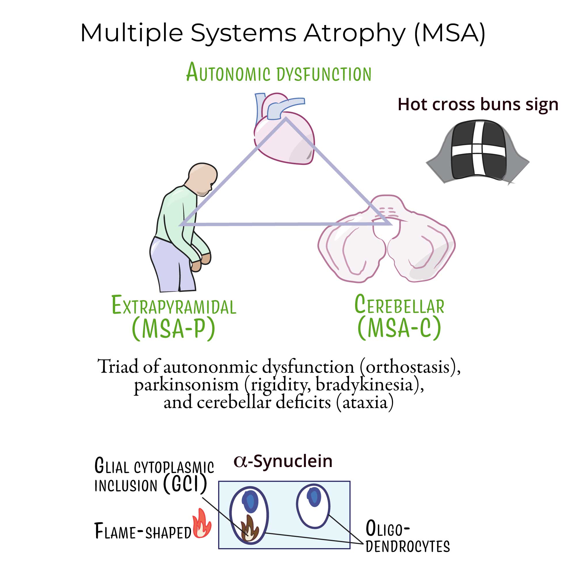 shy-drager syndrome