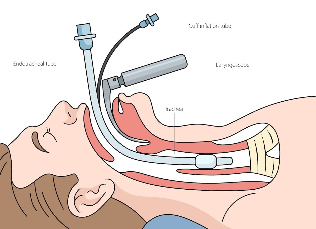 skeletal muscle relaxation for endotracheal intubation