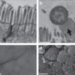 skin and skin structure citrobacter infection
