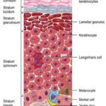 skin and skin structure clostridium infection