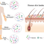 skin and skin structure fusobacterium infection