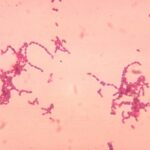 skin and skin structure peptostreptococcus infection