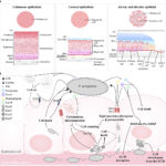 skin and skin structure pseudomonas aeruginosa infection