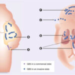 skin and skin structure streptococcus agalactiae infection