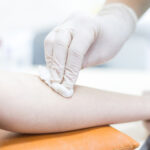 skin disinfection