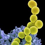 staphylococcus aureus complicated uti