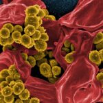 staphylococcus aureus endocarditis