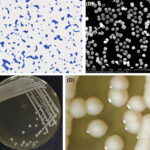 staphylococcus epidermidis urinary tract infection
