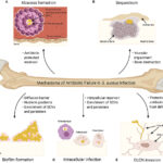 staphylococcus osteomyelitis