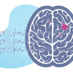 status epilepticus