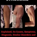 stiff-man syndrome