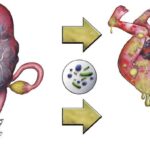 streptococcal septic abortion