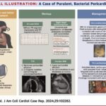 streptococcus pericarditis