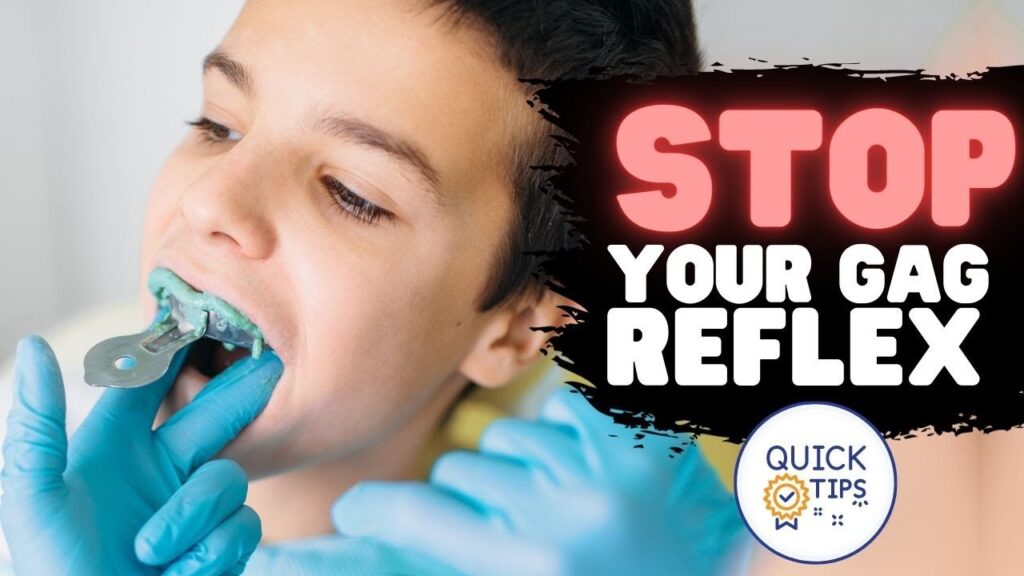 suppression of the gag reflex