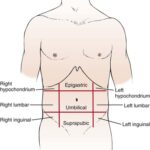 suprapubic pain