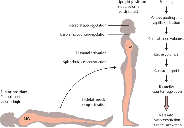 symptomatic orthostatic hypotension