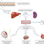 synergy for listeria monocytogenes septicemia