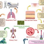 synergy for nosocomial pneumonia due to pseudomonas aeruginosa
