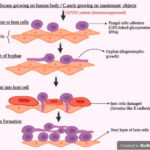 systemic candidiasis treatment adjunct