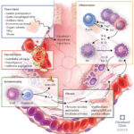 systemic sclerosis-associated interstitial lung disease