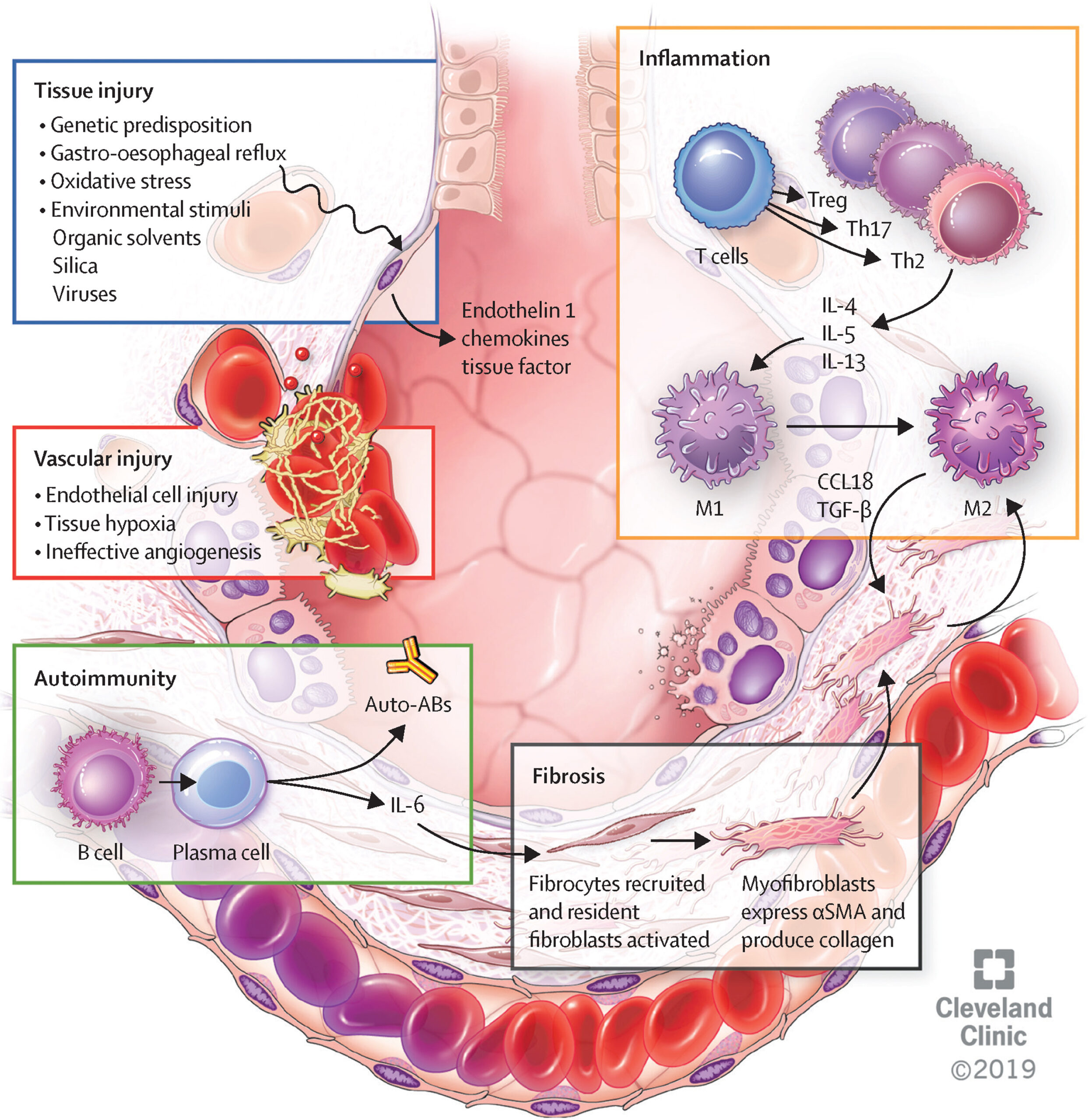 systemic sclerosis-associated interstitial lung disease