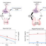 t3 suppression for thyroid function test