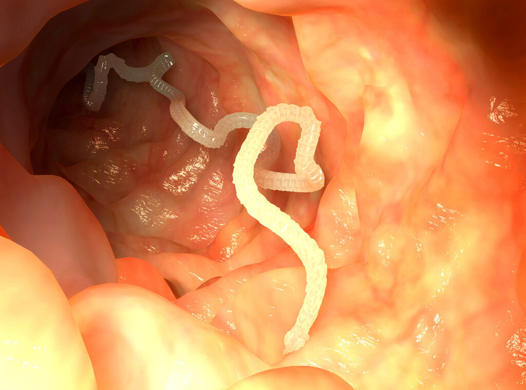 taenia infection