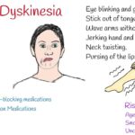 tardive dyskinesia