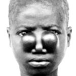 tertiary yaws