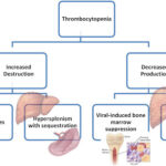 thrombocytopenia associated with chronic hepatitis