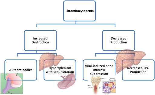 thrombocytopenia associated with chronic hepatitis