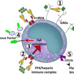 thrombosis with heparin-induced thrombocytopenia during percutaneous coronary intervention