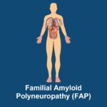 transthyretin familial amyloid polyneuropathy