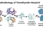 transthyretin-related amyloid cardiomyopathy