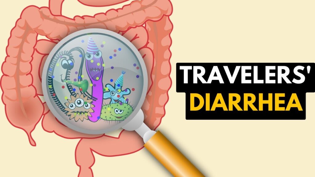 traveler's diarrhea