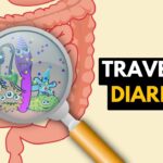 traveler's diarrhea
