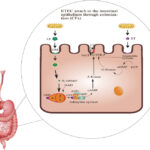 traveler's diarrhea due to noninvasive strain of escherichia coli