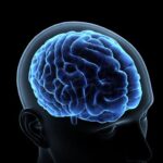 treatment-resistant schizophrenia