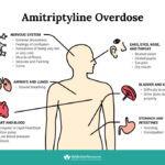 tricyclic antidepressant overdose