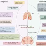 tuberculosis meningitis treatment adjunct
