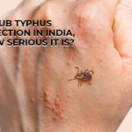 typhus infections