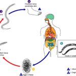 uncinariasis
