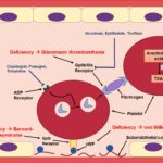 uremic bleeding tendency