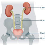 urinary tract irritation