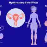 vaginal hysterectomy infection prevention