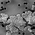 vancomycin resistant enterococcus faecium bacteremia