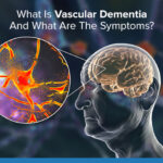 vascular dementia